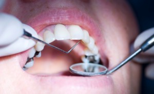 empaste dental clinica
